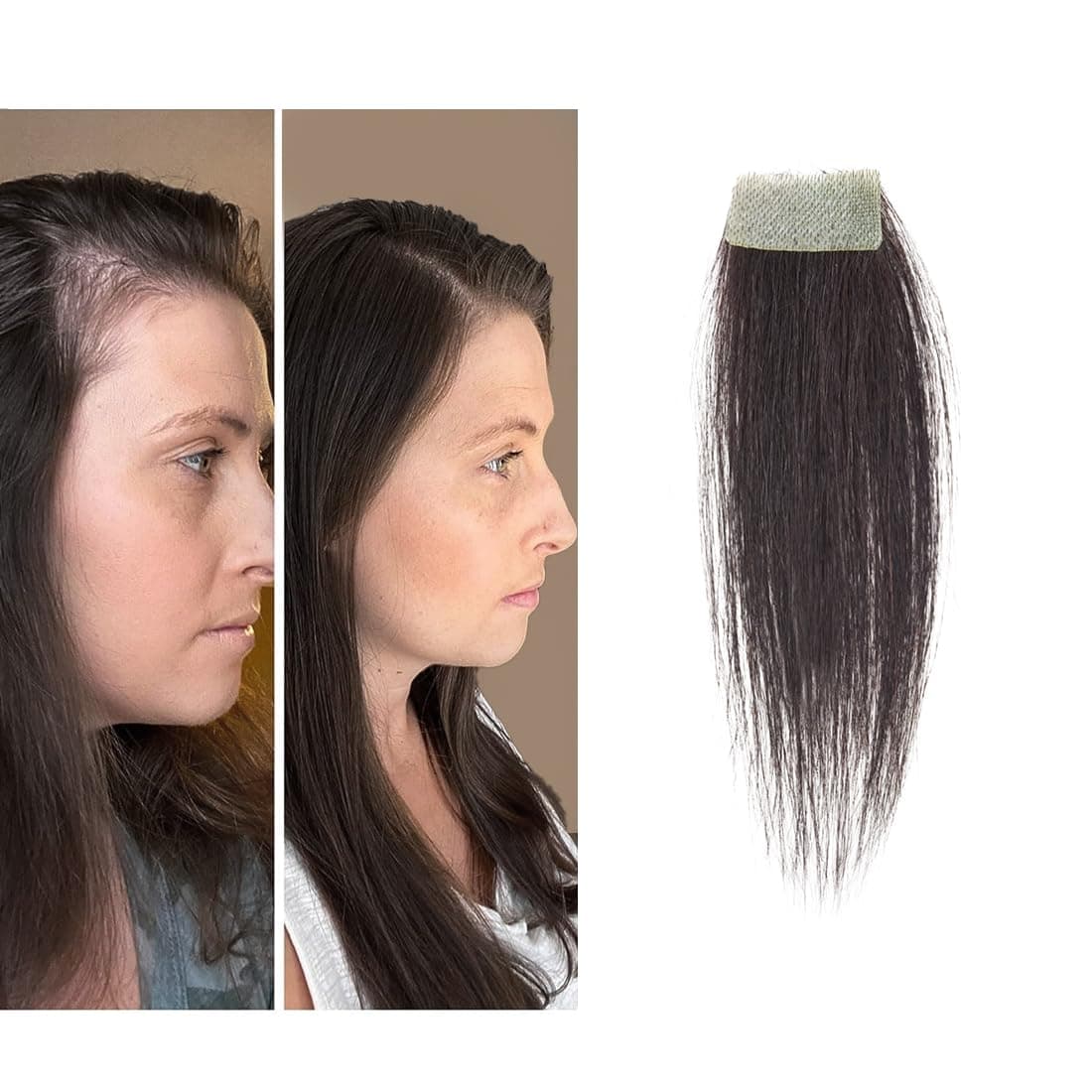 scar human hair replacement Accidental burns without hair for men women Hairline Loss Straight Tape in Replacement Toupee (Natural Black, 0.78"x1.5")