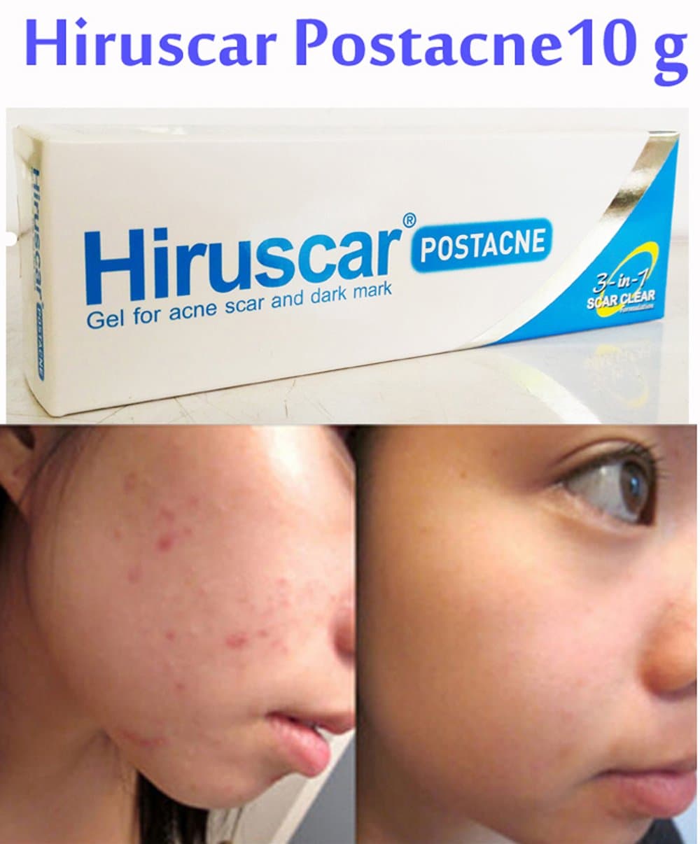 Hiruscar Post Acne Gel 10 g Dark Mark Relief Scar Acne Clear 3 in 1 Smooth Skin